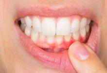 Good Dental Hygiene How To Take Care of Your Teeth and Gums